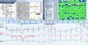 Холтеровский монитор ЭКГ SCHILLER medilog DARWIN, ПО ScanLab