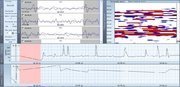 Холтеровский монитор ЭКГ SCHILLER medilog DARWIN, ПО ScanLab