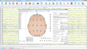 Электроэнцефалограф экспертного класса Нейрон-Спектр-5, 32 канала ЭЭГ