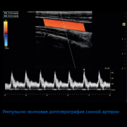 УЗИ аппарат Versana Essential 4 датчика, принтер (общие исследования)