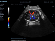 УЗИ аппарат Mindray DC-N3 Общие исследования