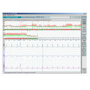 Холтеровский регистратор ЭКГ Валента МН-05