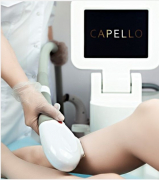 Лазер косметологический CAPELLO E-light (Элос, RF)