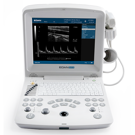 УЗИ-аппарат Edan DUS 60 для проф.осмотров и флебологии