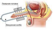 Многофункциональный комплекс «Мустанг-УроГин»