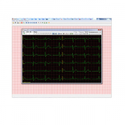 Компьютерный электрокардиограф КРП-01 НПП "МОНИТОР"