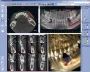 Дентальный цифровой томограф ProMax Classic 3D