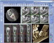 Дентальный цифровой томограф ProMax Classic 3D