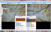 Программное обеспечение для трихоскопии TrichoSciencePro