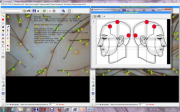 Программное обеспечение для трихоскопии TrichoSciencePro